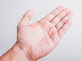 Отчего трескается кожа на пальцах рук?